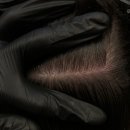 벨르뮤SMP신중동점 | 부평헤어라인 정리로 자연스러움 살린 SMP 벨르뮤 신중동점 후기