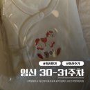 백운 한방병원 | [임신일기 #14] 30-31주차 백일해주사, 임산부자동차등록, 쿠킹클래스, 발목접지름(발목 부상 이슈)