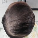 광주기독병원 | [생후6개월차]두상교정 여정기/사두증/광주기독병원/초진/지오헬멧/후기