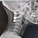 경희믿음한의원 | 👉 경희구암한의원 내돈내산 후기｜목, 어깨 통증 치료 제대로 받은 곳