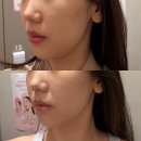 약손명가 에스테틱(합정역점) | 합정에스테틱 합정웨딩관리 약손명가합정역점 웨딩신부관리 후기!