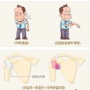 바름관리 이미지