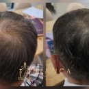 알미공원(중) 이미지