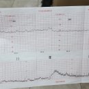 시청로 27~시청로 37 | [임신38주]태동검사,만삭혈압,만삭태동,임신후기아기위치