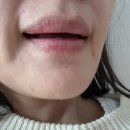 꽃내음약국 | 약국 큐립 연고 가격, 구순염 립밤 추천 후기 끈적임 없이 촉촉