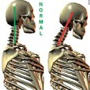 보행 분석을 위한 중요한 개념 Pelvis–thorax coordination 이미지