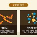 성인 폐렴 & 소아 폐렴 차이점 중증의 호흡기 감염병 이미지