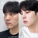 제로원성형외과의원