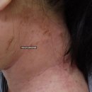 청아한의원 마포｜아토피 환자였던 제가 진료실에서 가장 많이 떠올리는 순간
