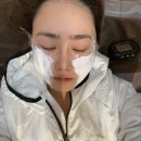 더샤인한스의원 | 신논현역 피부과 리쥬란 더마샤인 시술효과 통증 솔직후기