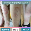 제이케이라온 | 리셀 더마크림의 놀라운 후기!!! 🫢🫢