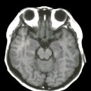 교동한의원 이미지