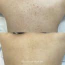 명성메디칼 | [ 홍대여드름 | 홍대에스테틱 ] 후기좋은 고객만족 1위 에스테틱, 홍대에 상륙하다 !