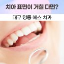 명동에스치과의원 | 대구 명동 에스 치과, 치아 표면이 거칠게 느껴지면 문제일까요?
