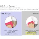 이든치과기공소 이미지