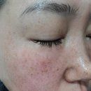 인셀덤 바라기