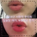 삼일한의원 | 내돈내산 듀얼토닝 및 점 제거 서현역한의원 만족 후기