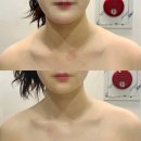 청주 윤곽관리 후광미인 뱀부윤곽관리