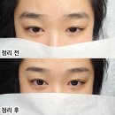 대구눈썹정리 브로우바 엘엠제이 퍼스널브로우컨설팅 받은 후기