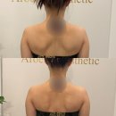 아로美피부관리실 | 황금동 피부관리 아로엘라 대구 에스테틱 추천 후기