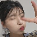 향남바로병원 | 향남 피부과 젠틀맥스프로 플러스 풀페이스 얼굴 제모 후기