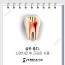 덕계베스트치과의원 네이버블로그