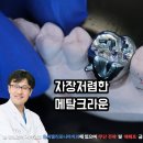 치아크라운가격 3대장은 무엇인가요?