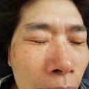 Home Care 이미지