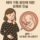 유전사우나 | “유전 때문일까? 생활습관 때문일까? 태아 기형 원인 총정리”