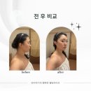 성수 얼굴 경락 추천 위뷰티성수점에서 턱살 빼는 법! 이중턱 뿌셔뿌셔~
