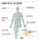 당뇨 합병증 막으려면 병원도 골라 다녀야한다 이미지