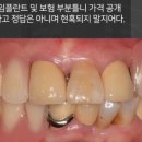 서울치과 이미지