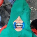 트리베일러(Baylor)치과의원 | 용인 치아미백, 트리베일러치과 덴탈에스테틱 내돈내산 후기