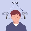 마포좋은보청기 이미지