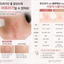 고운빛의원 티스토리