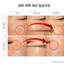 앰플 :: 화이트닝주름기미앰플 13.5%순수비타민C 비타씨 플러스 앰플 :: 라바섬 필러 비타씨 플러스 앰플