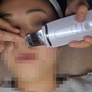 수성구피부관리 알로하에스테틱 대구여드름관리 후기