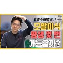 모발이식 평생 몇 번(몇 모) 가능할까? 이미지