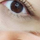 예쁜EYE 이미지