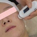 퀸 다경뷰티 | 군산 퀸다경뷰티 모공디톡스 관리 후기 | 수분은 올리고 유분은 내리기~!
