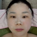 광안1동 수영구보건소 주차장 | [부산] 수영구체형관리 미인본가 수영점 | 작은얼굴 윤곽관리 후기