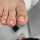 패디히얼