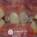 박상욱치과의원 네이버블로그
