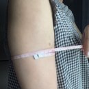 차박사카클리닉 | 인천 구월동 비만클리닉 지방분해주사 3회차 팔뚝 라인 관리하기