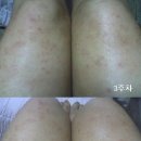 에버노블 Daum카페