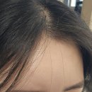 흥미헤어라인 이미지
