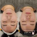 고운:결 | 부평 굴포천 피부관리 &lt;결, 결이고운&gt; 고주파 리프팅관리 후기