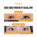서면 눈재수술 손상이 되지 않도록 주의하면서