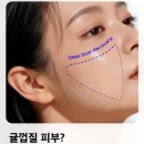 픽셀랩성형외과의원 네이버블로그