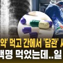 '미국산 약' 먹고 간에서 '담관' 사라졌다..8천5백명 먹었는데 일 '발칵' (자막뉴스) / SBS 이미지